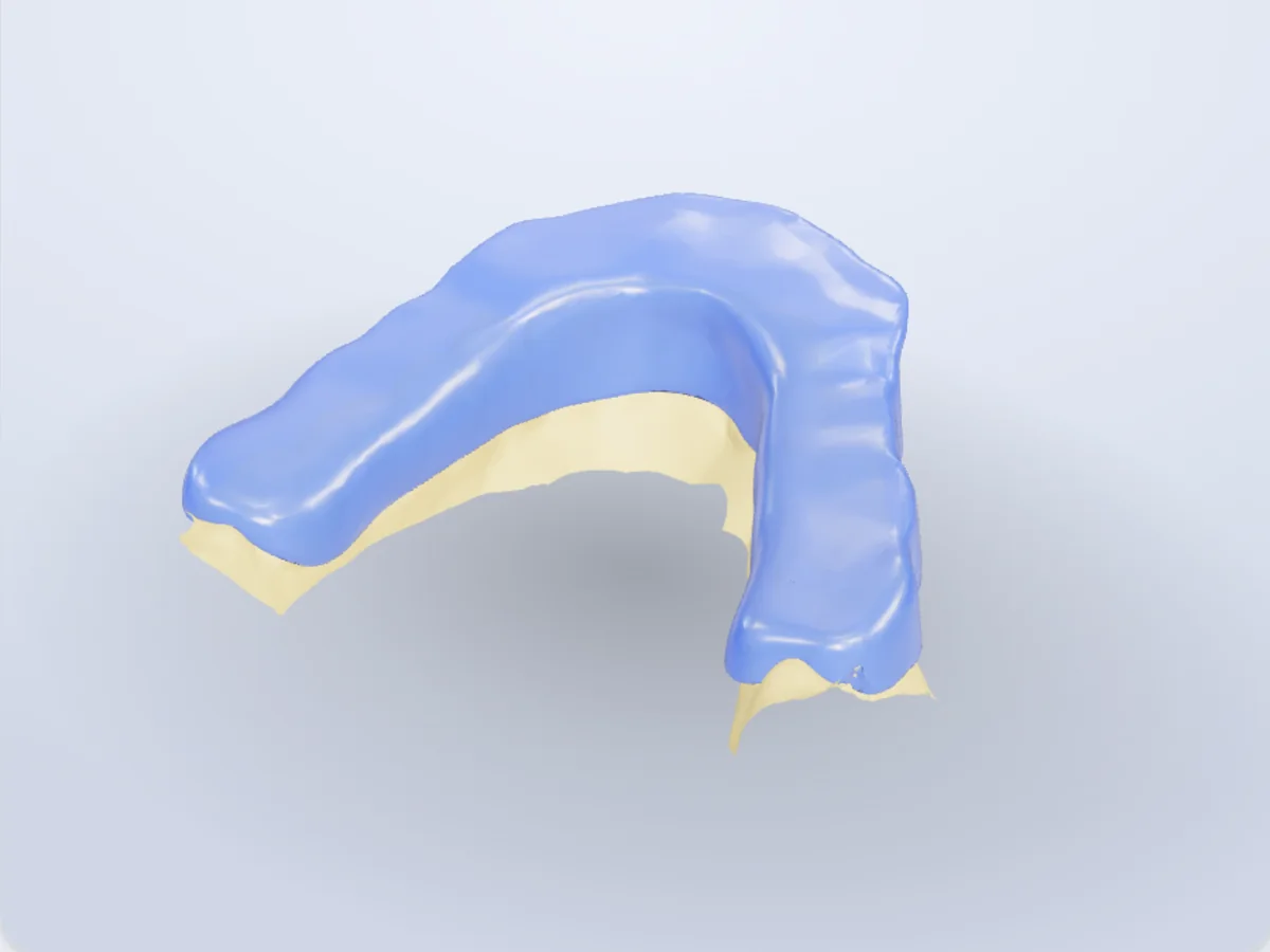 The NexorCAD designer with a finished lower splint on the scanned arch.