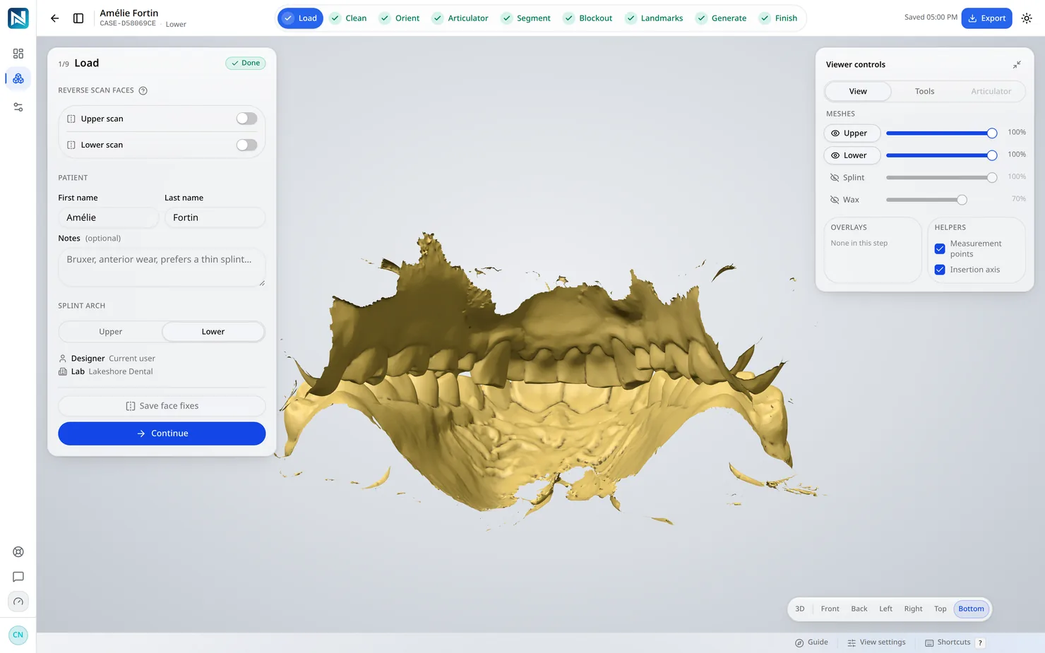Load — Drop in the upper and lower scans exactly as the scanner exported them. STL or PLY, no conversion.